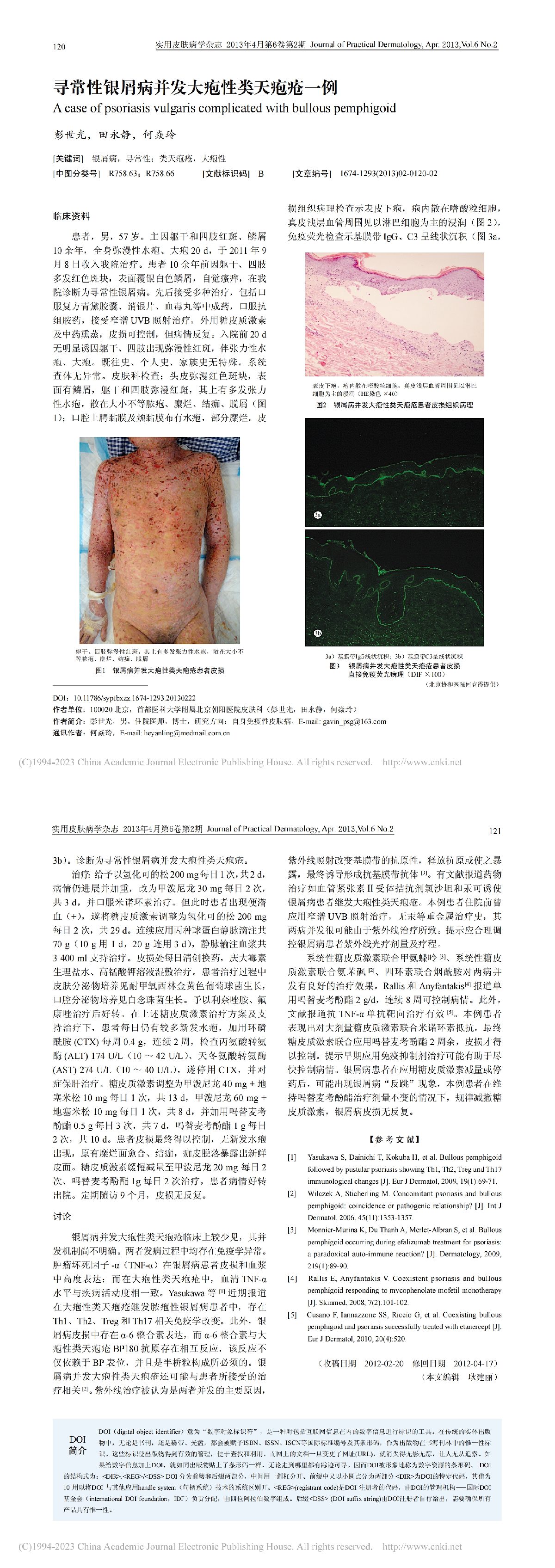 寻常性银屑病并发大疱性类天疱疮一例