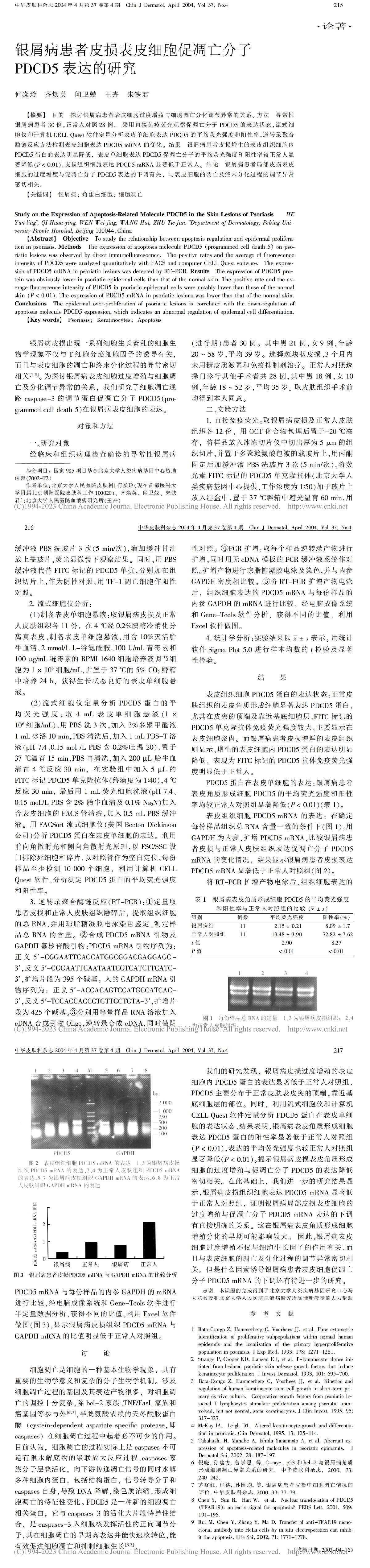 银屑病患者皮损表皮细胞促凋亡分子PDCD5表达的研究