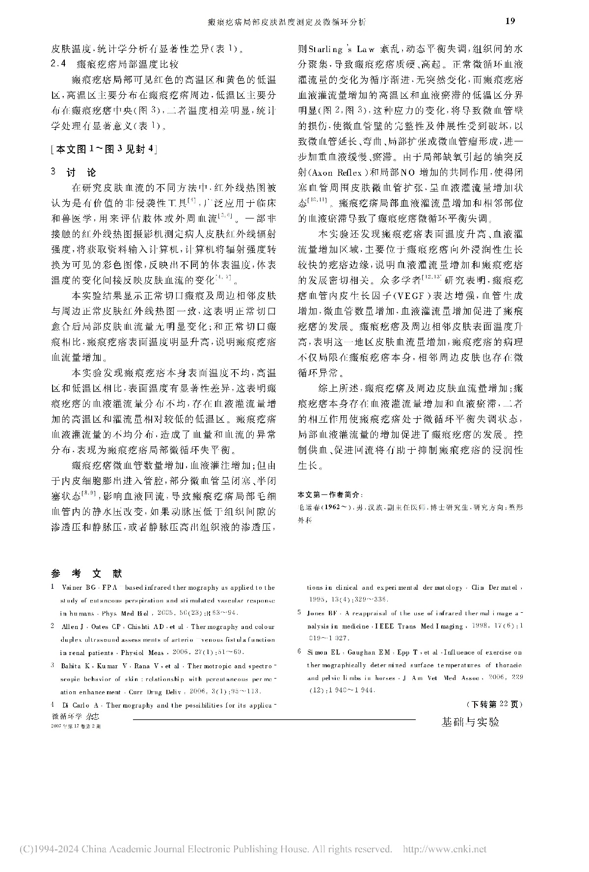 瘢痕疙瘩局部皮肤温度测定及微循环分析