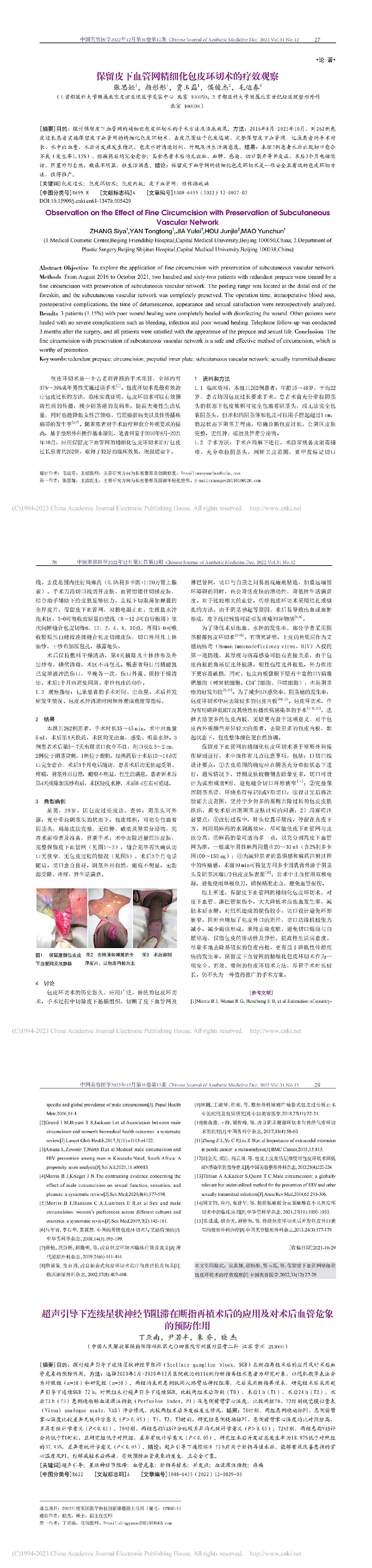 保留皮下血管网精细化包皮环切术的疗效观察