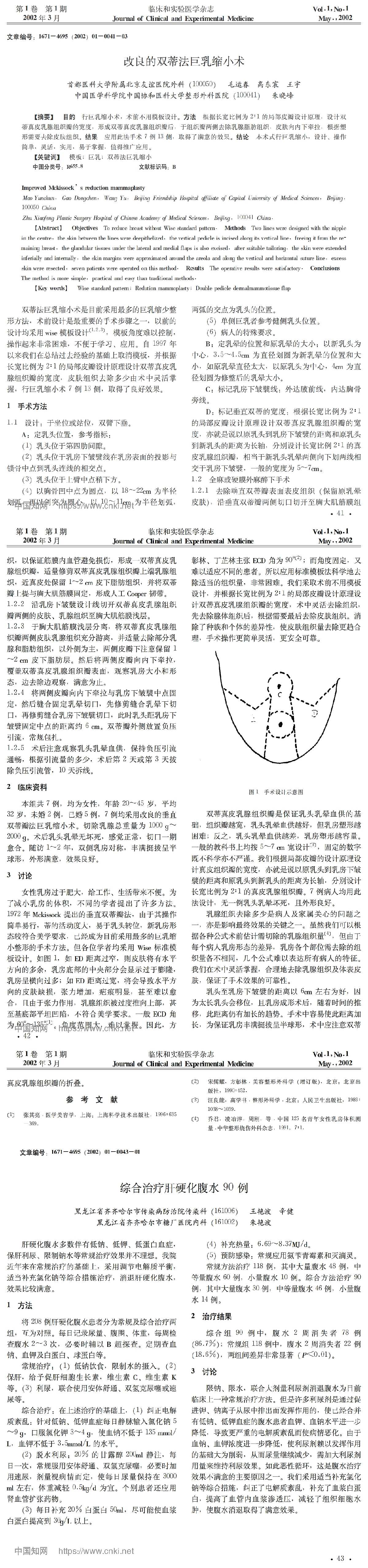 改良的双蒂法巨乳缩小术