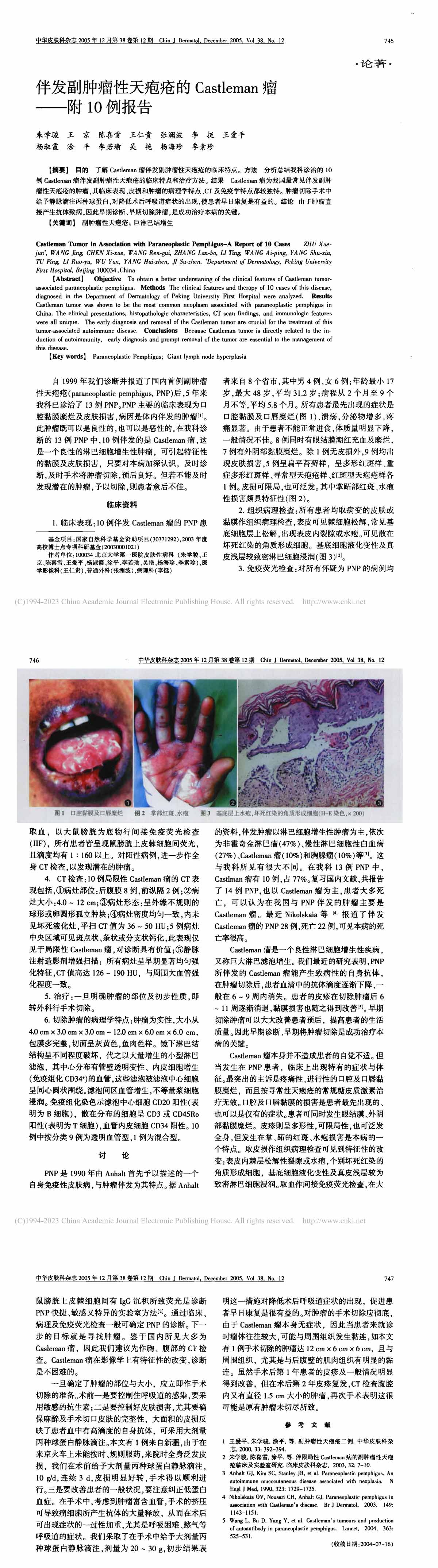 伴发副肿瘤性天疱疮的Castleman瘤——附10例报告