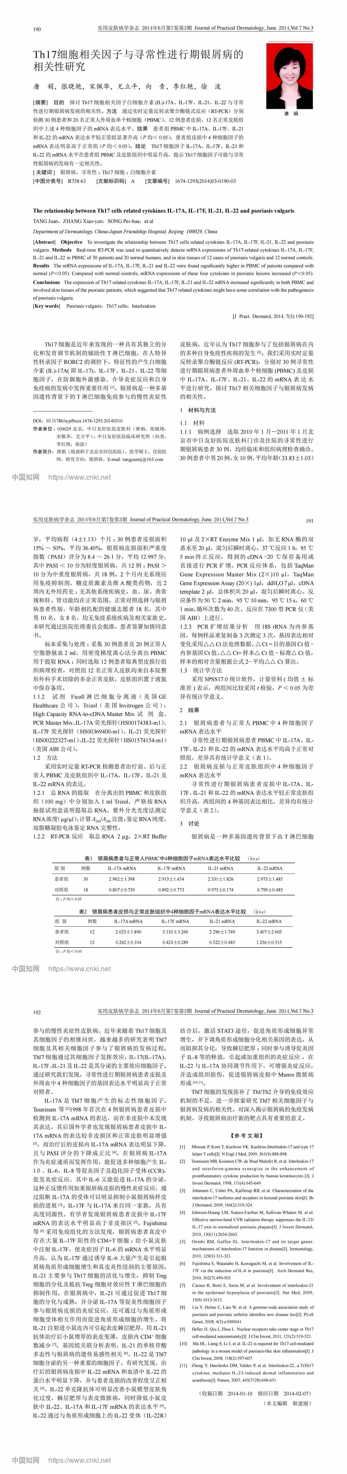 Th17细胞相关因子与寻常性进行期银屑病的相关性研究