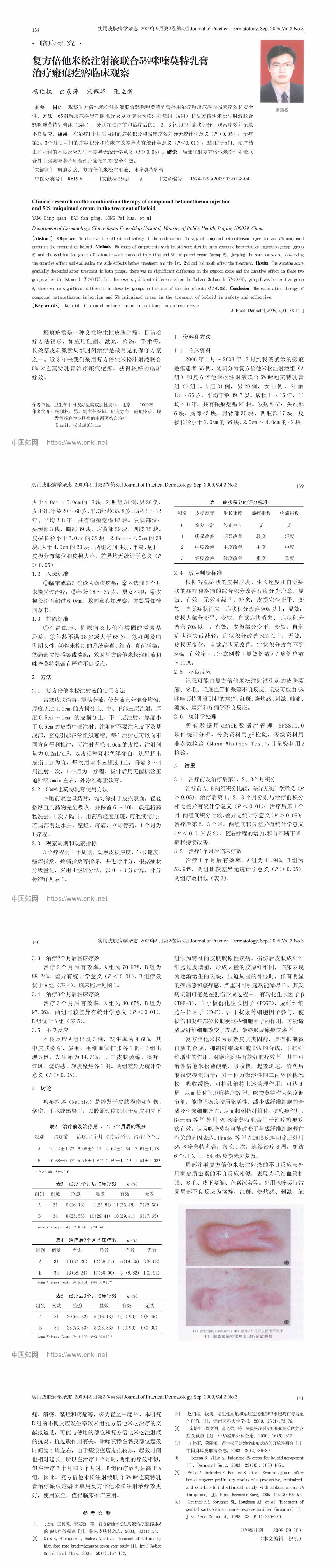 复方倍他米松注射液联合5%咪喹莫特乳膏治疗瘢痕疙瘩临床观察
