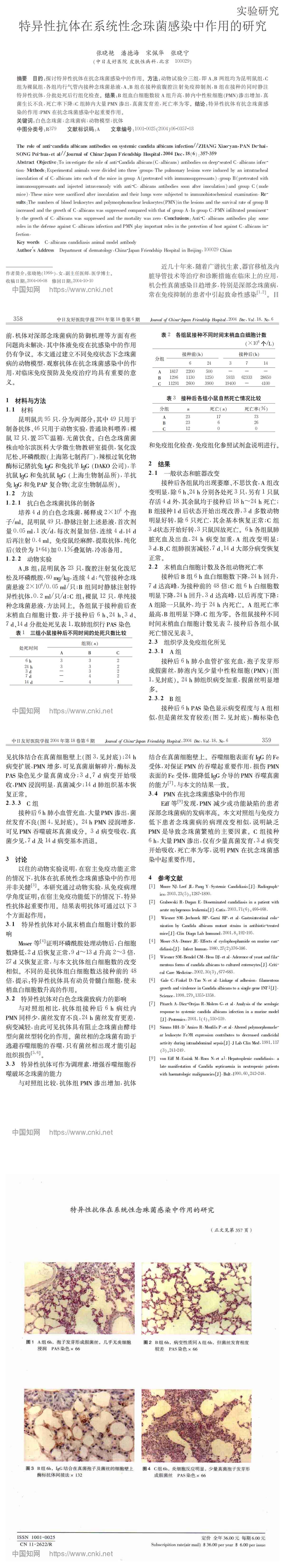 特异性抗体在系统性念珠菌感染中作用的研究