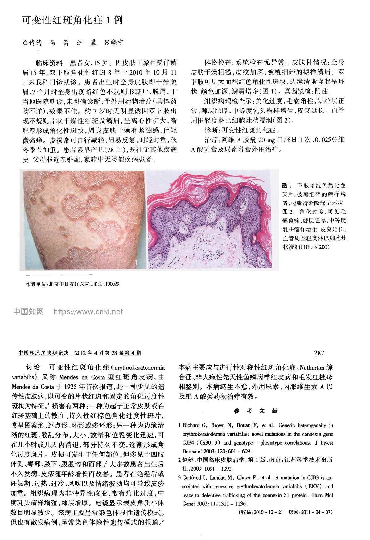 可变性红斑角化症1例