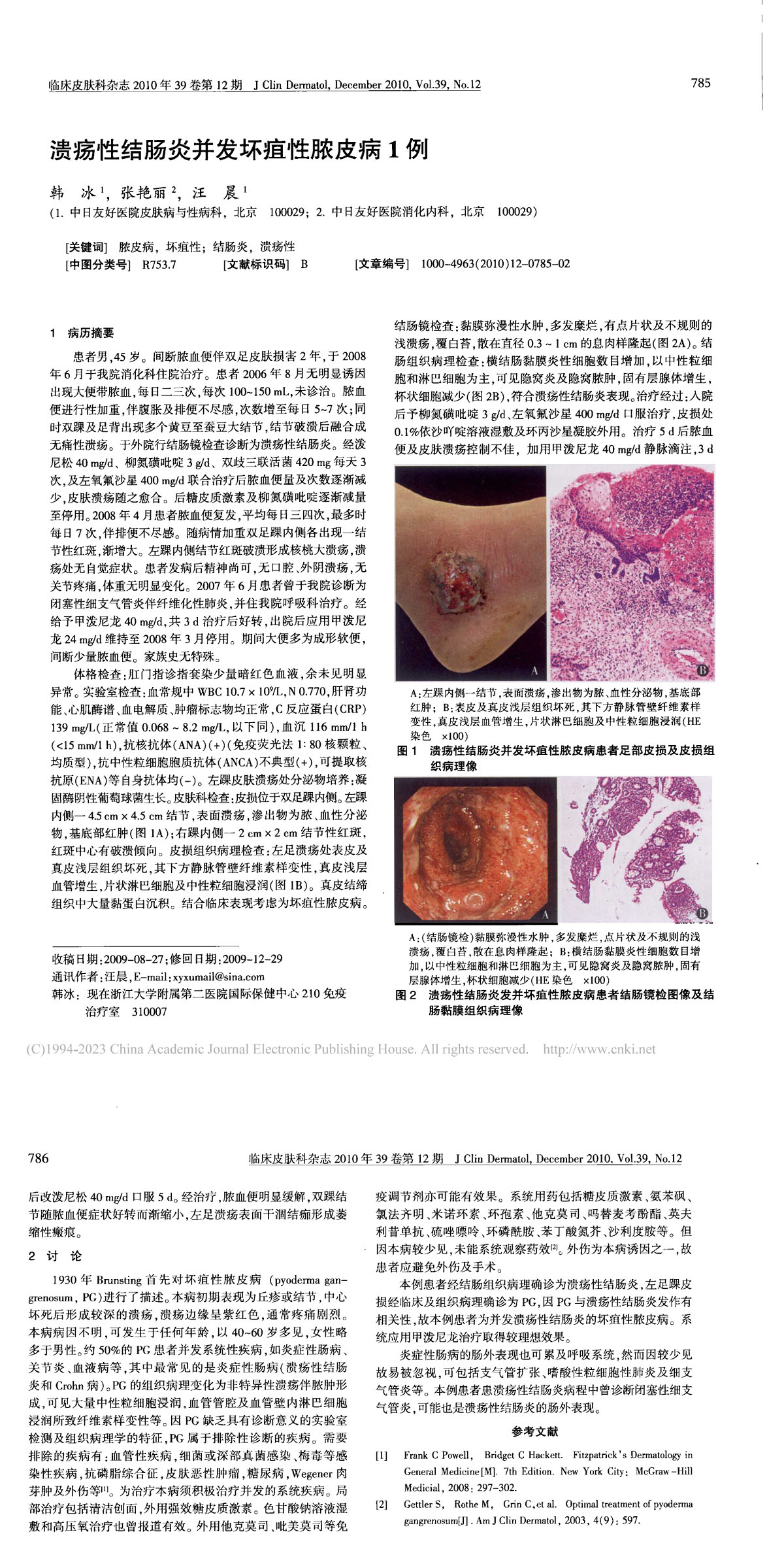 溃疡性结肠炎并发坏疽性脓皮病1例