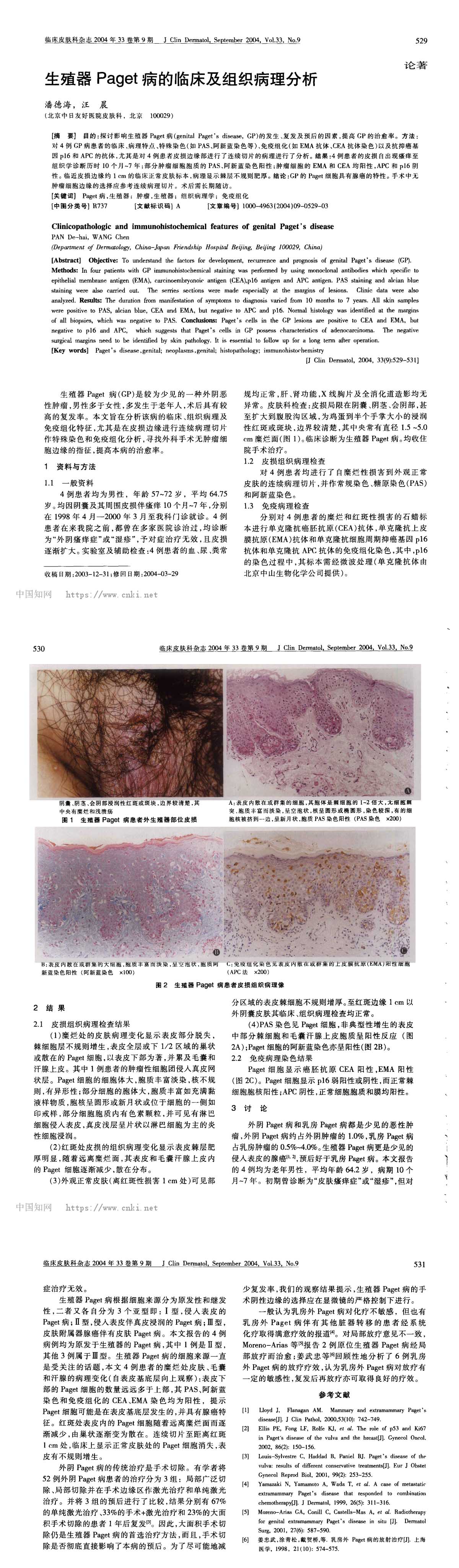 生殖器Paget病的临床及组织病理分析