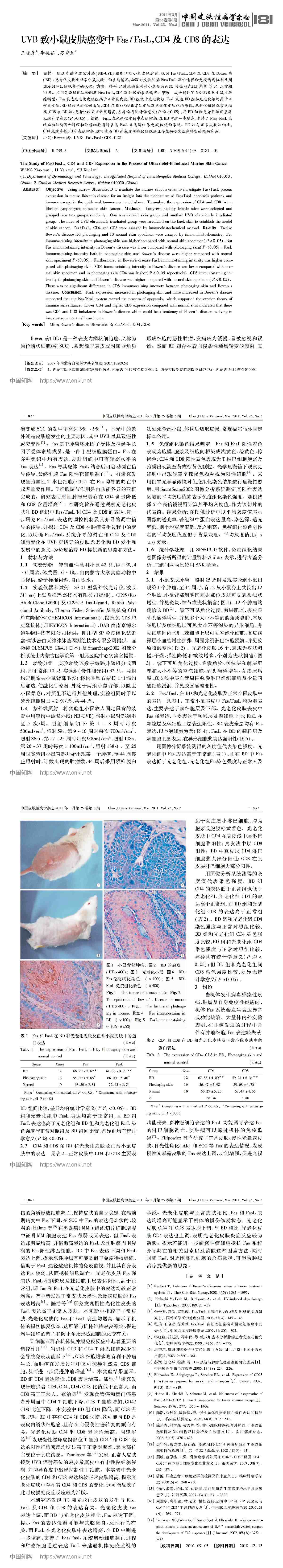 UVB 致小鼠皮肤癌变中 Fas/FasL，CD4 及 CD8 的表达