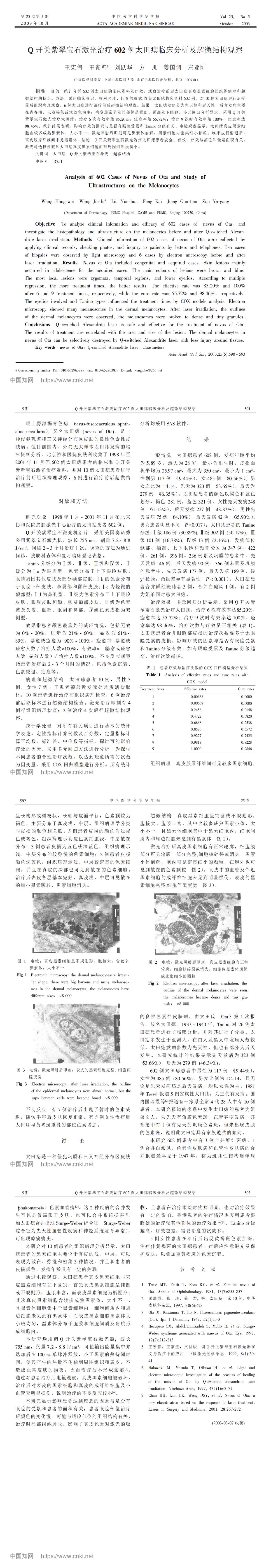Q开关紫翠宝石激光治疗602例太田痣临床分析及超微结构观察