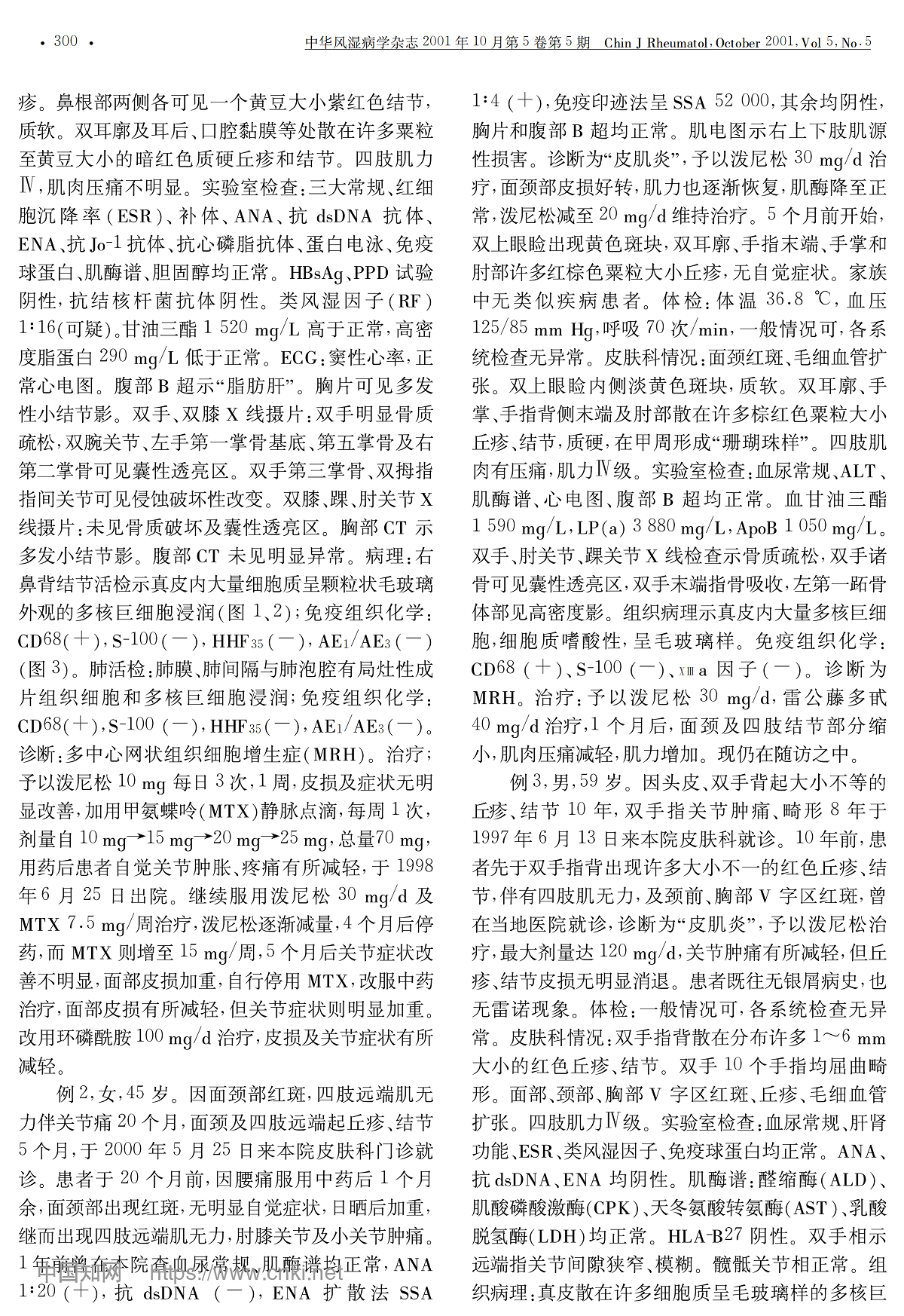多中心网状组织细胞增生症三例并文献复习