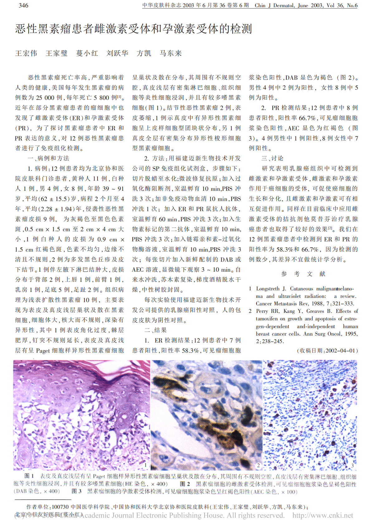 恶性黑素瘤患者雌激素受体和孕激素受体的检测