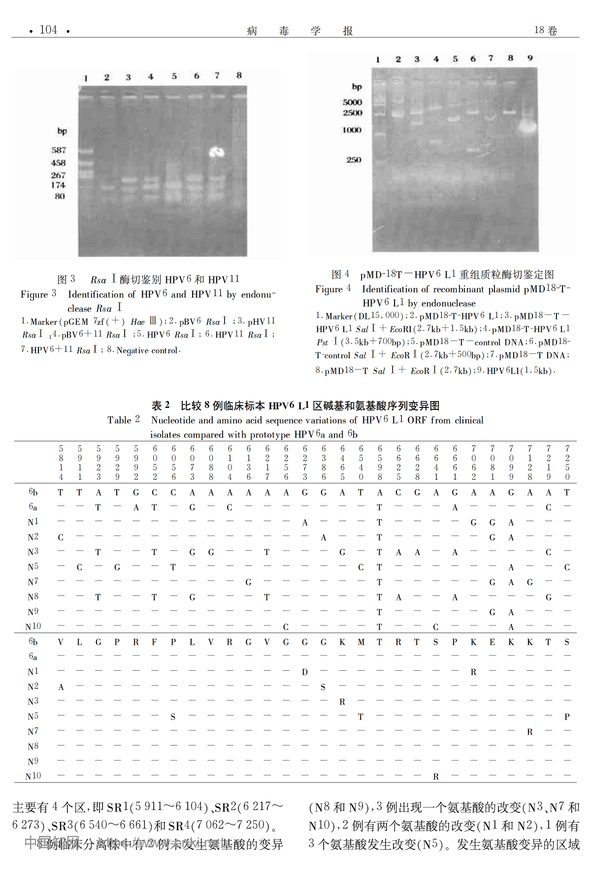 尖锐湿疣病变的人乳头瘤病毒6型 L1序列多态性分析