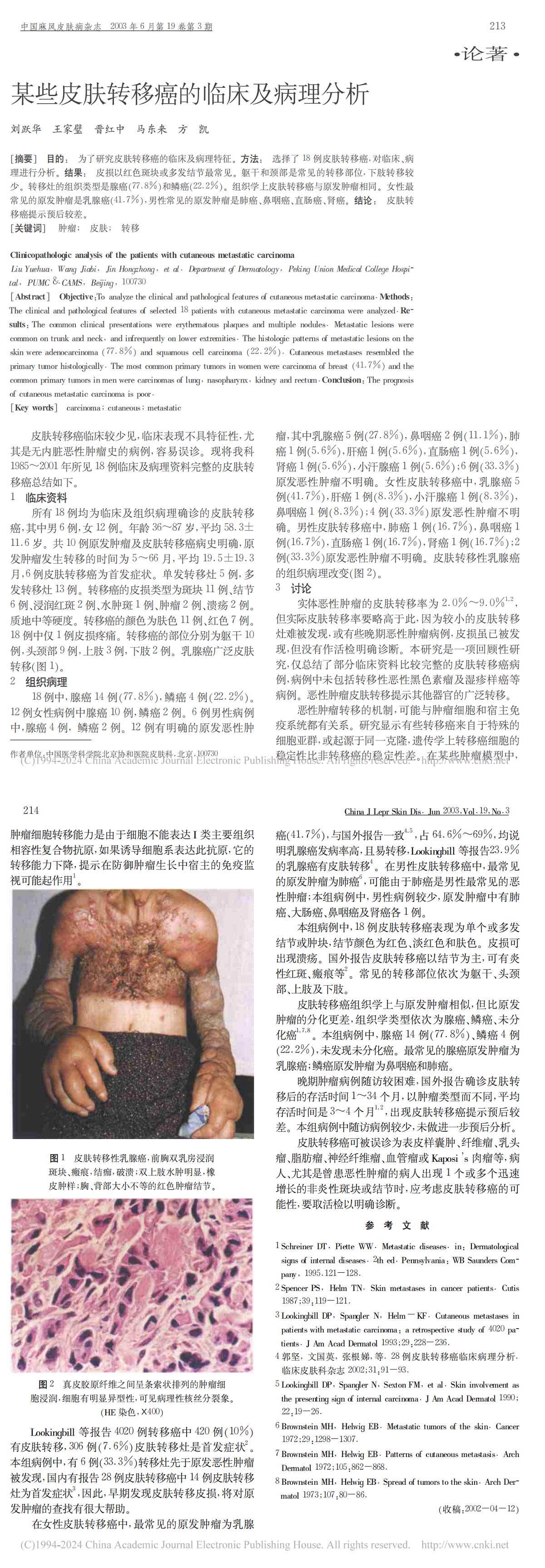 某些皮肤转移癌的临床及病理分析