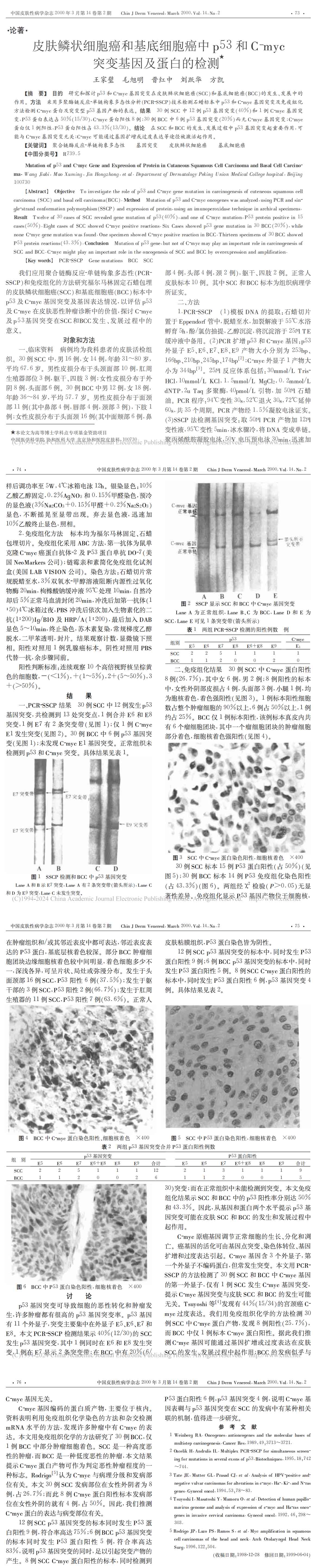 皮肤鳞状细胞癌和基底细胞癌中p53和 C-myc 突变基因及蛋白的检测