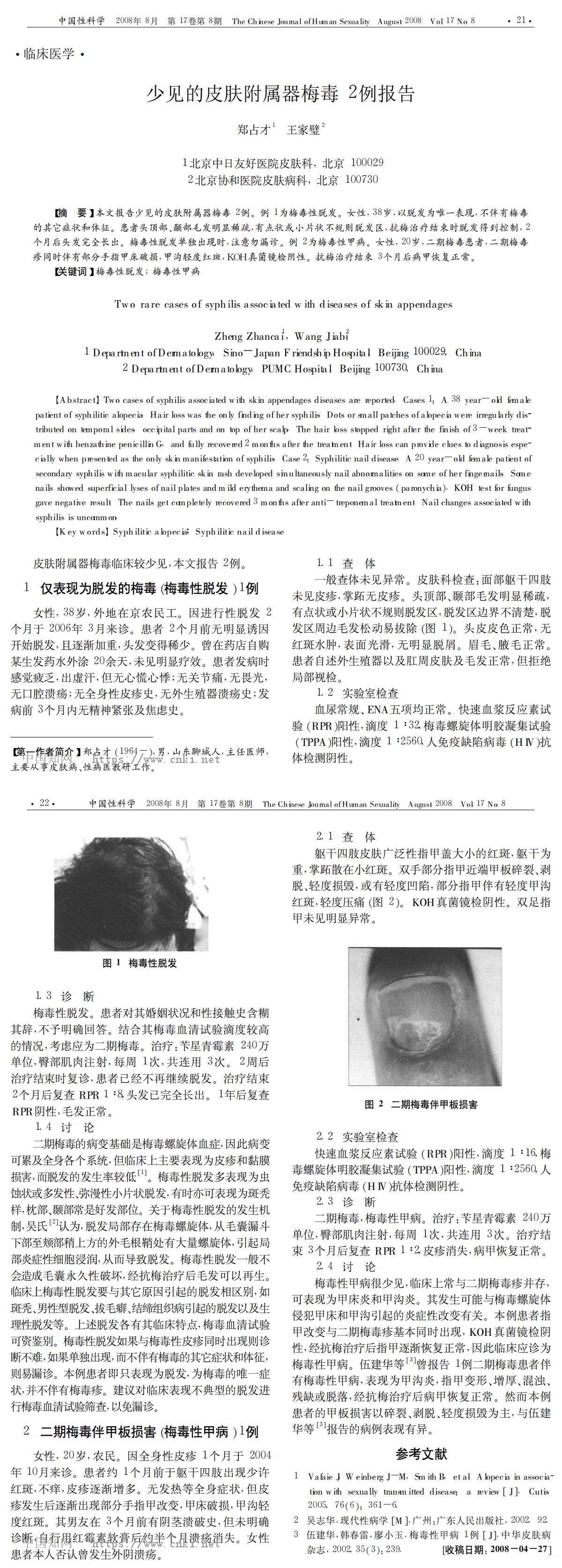 少见的皮肤附属器梅毒2例报告