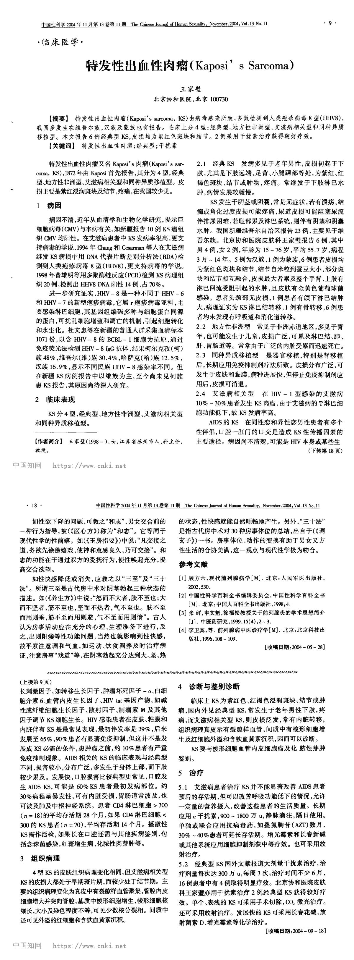 特发性出血性肉瘤(Kaposi’s Sarcoma)