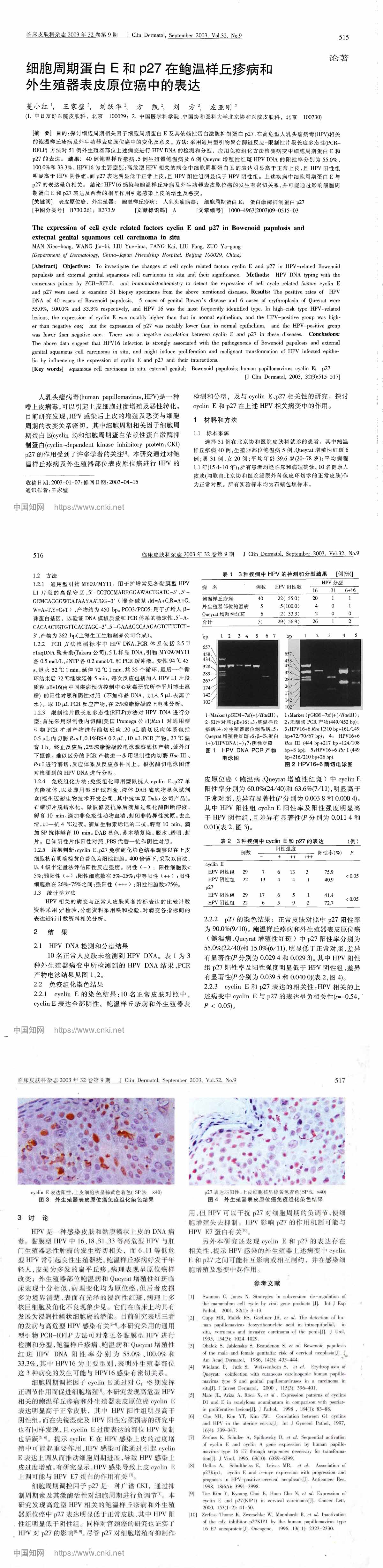 细胞周期蛋白E和p27在鲍温样丘疹病和外生殖器表皮原位癌中的表达