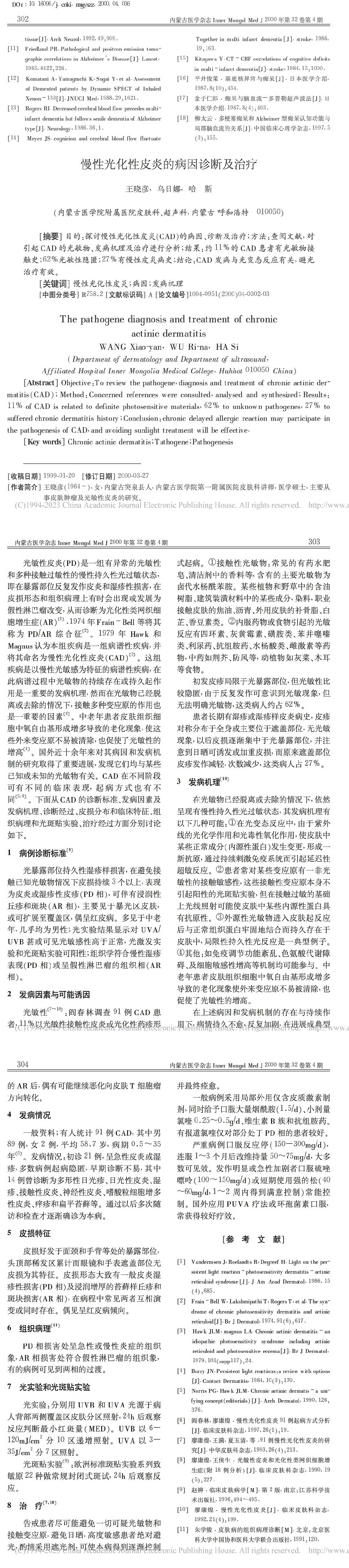 慢性光化性皮炎的病因诊断及治疗