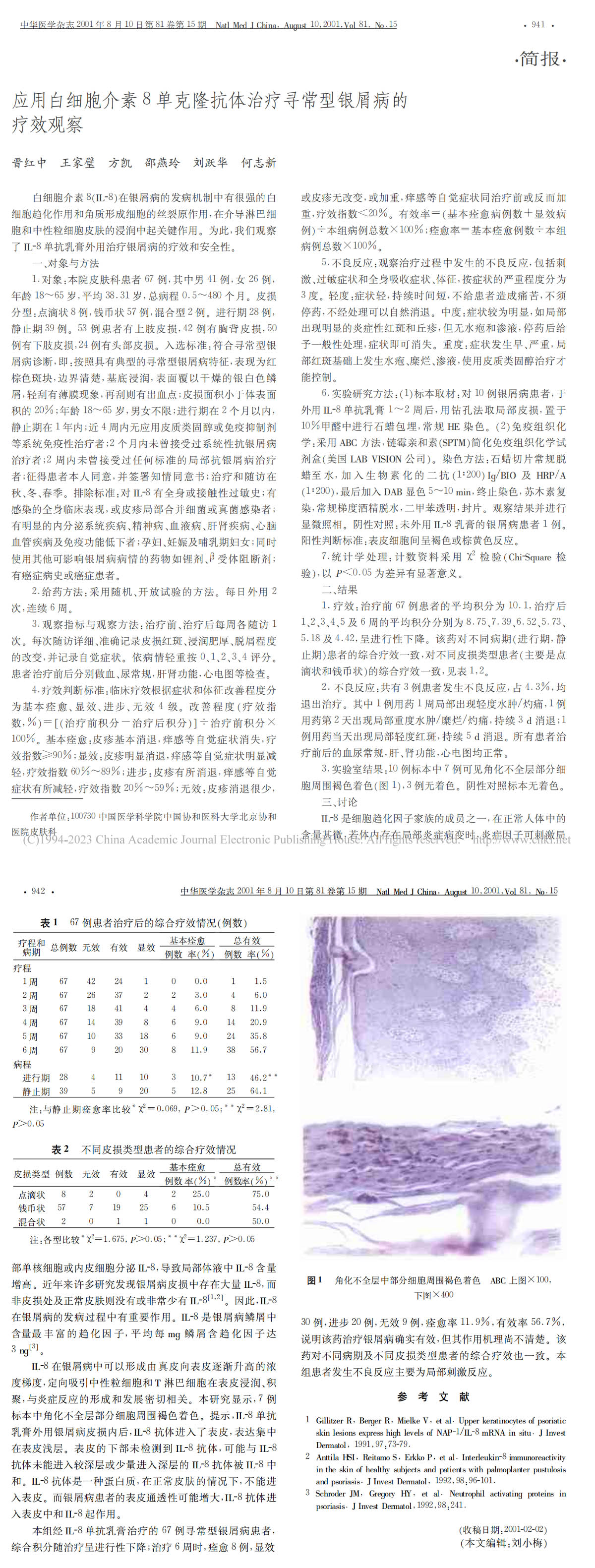 应用白细胞介素8单克隆抗体治疗寻常型银屑病的疗效观察