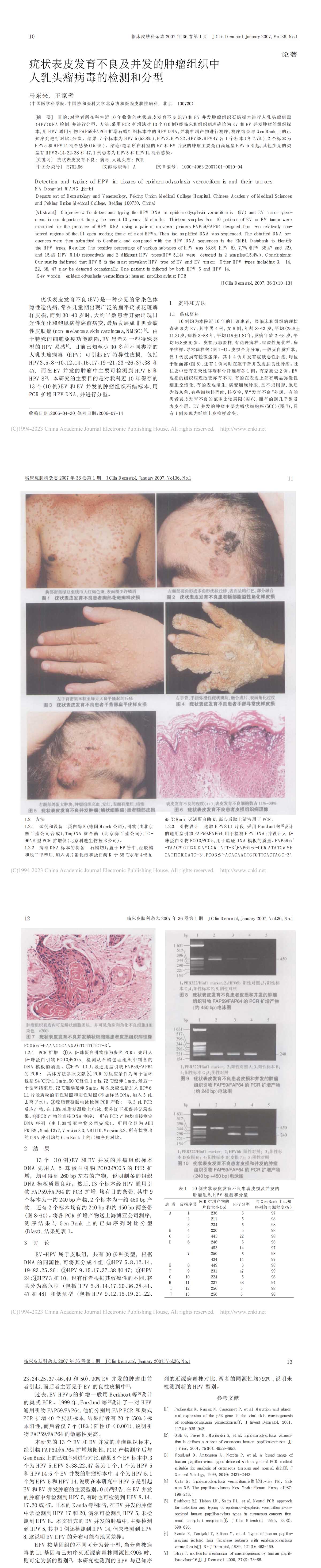 疣状表皮发育不良及并发的肿瘤组织中人乳头瘤病毒的检测和分型