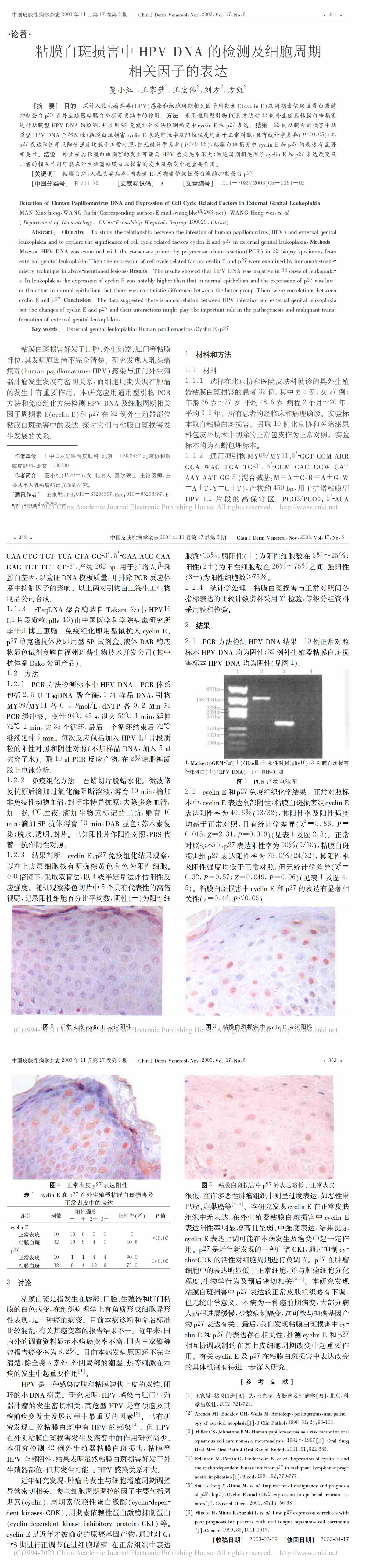 粘膜白斑损害中HPV DNA的检测及细胞周期相关因子的表达
