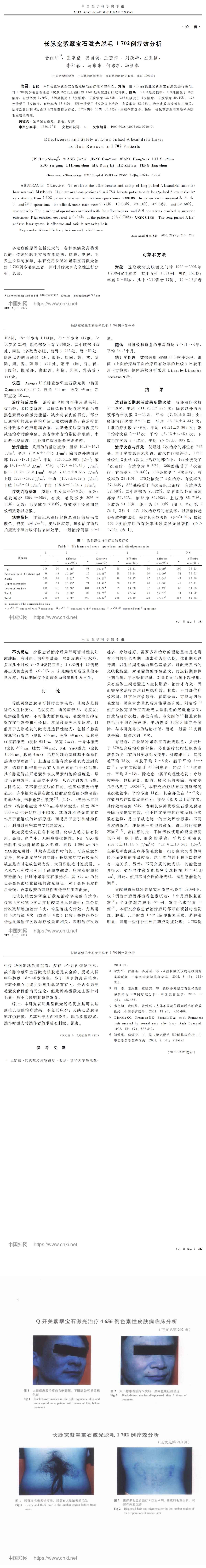 长脉宽紫翠宝石激光脱毛1702例疗效分析