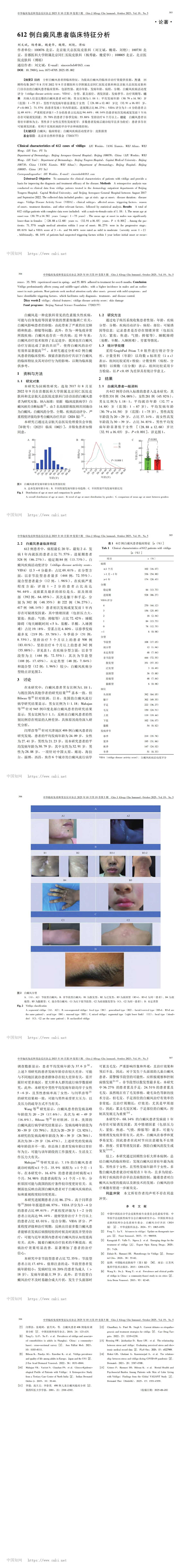 612 例白癜风患者临床特征分析