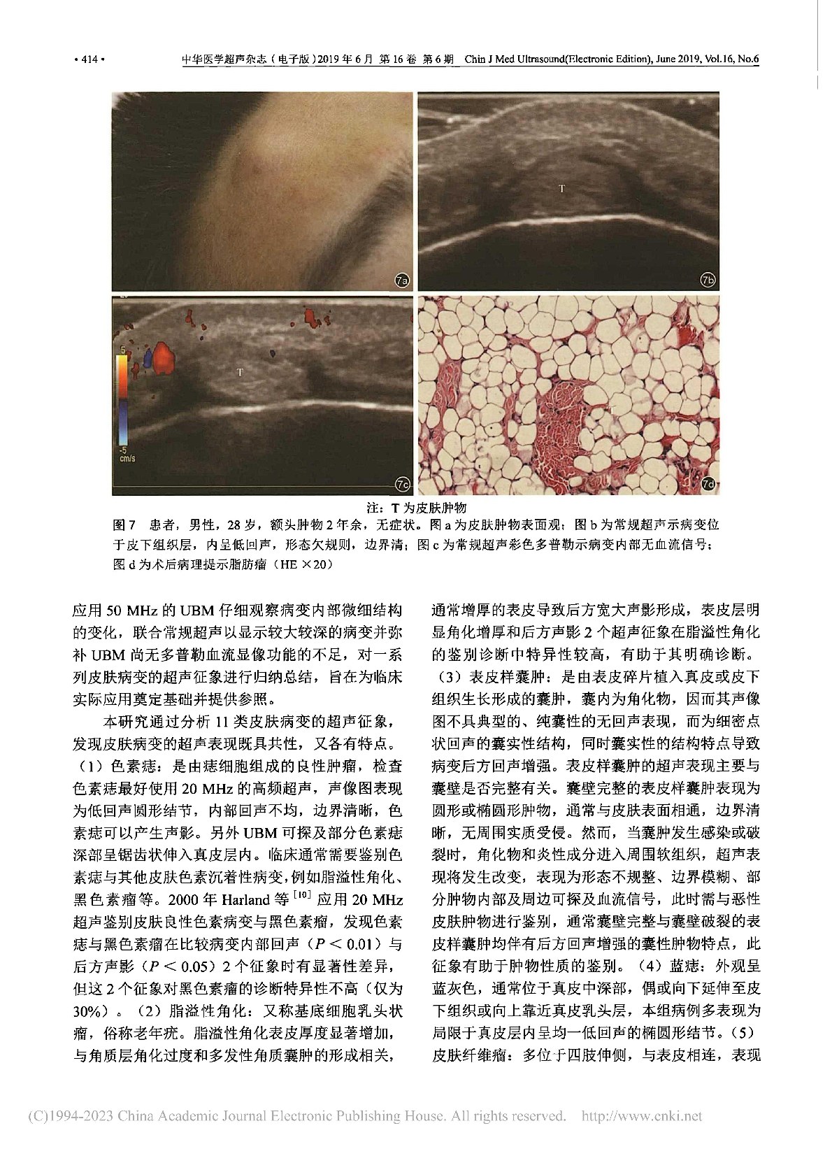 超声影像在皮肤病变诊断中的应用研究