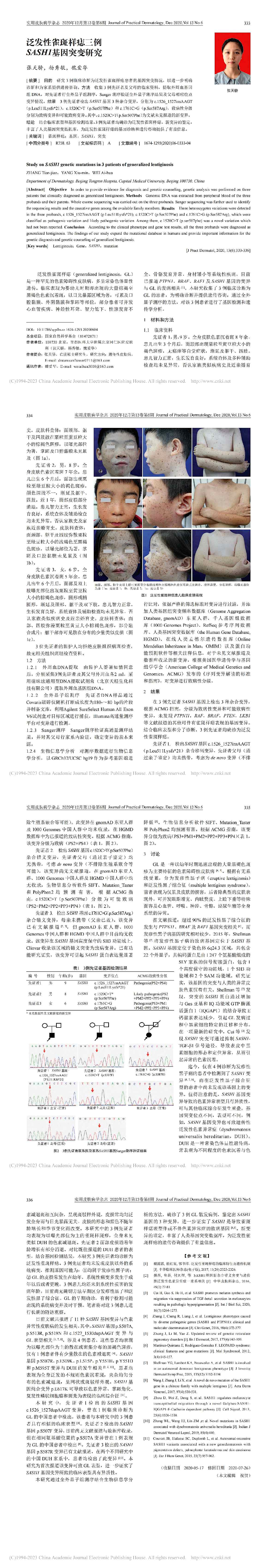 泛发性雀斑样痣三例SASH1基因突变研究
