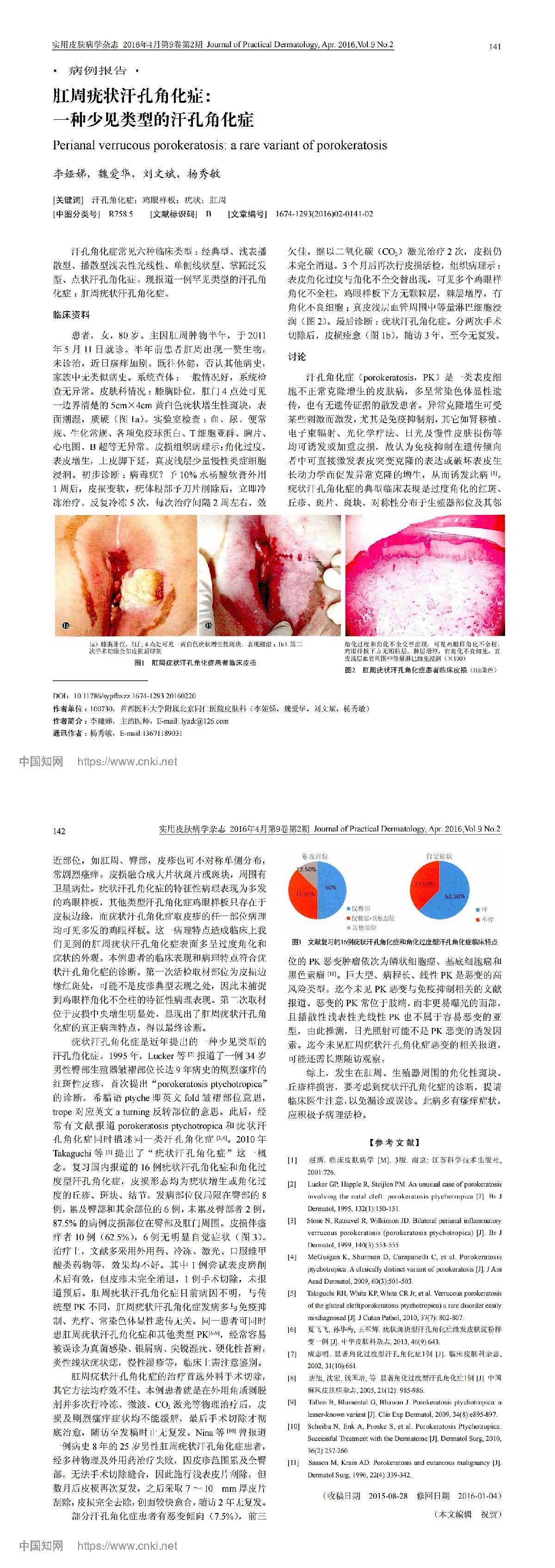 肛周疣状汗孔角化症：一种少见类型的汗孔角化症