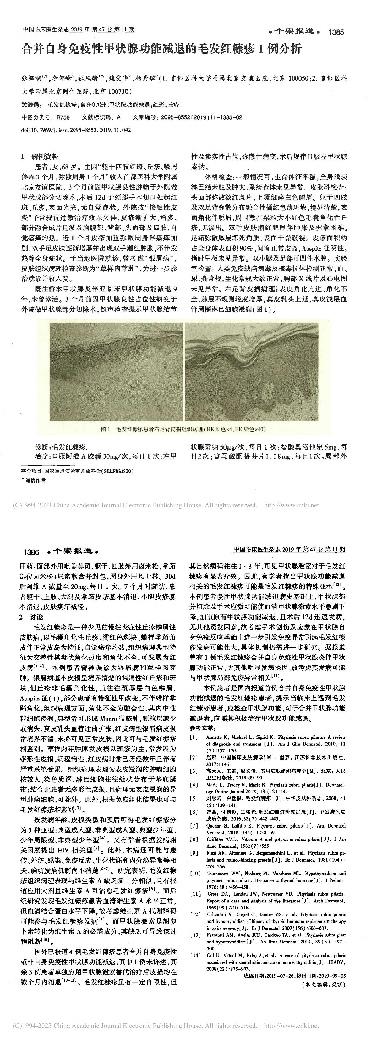 合并自身免疫性甲状腺功能减退的毛发红糠疹1例分析