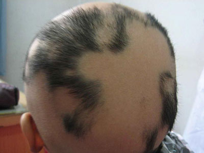 ѷĲЩ