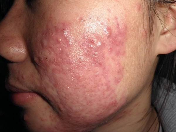 �����沿�ഺ���ķ���